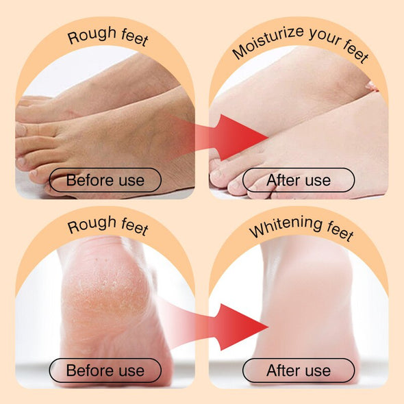 10 Pairs Ginger Foot Mask 